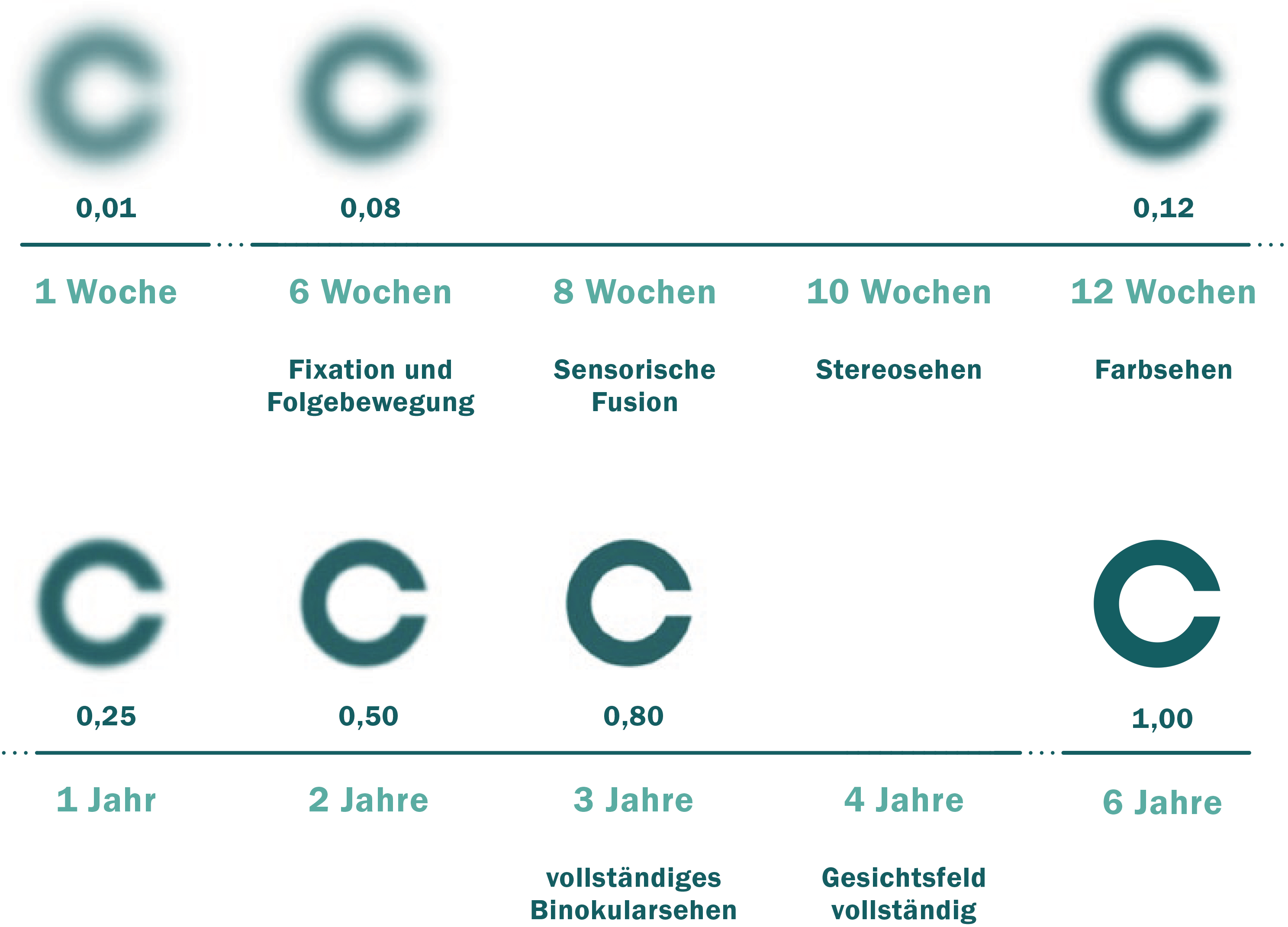 kontaktlinsen-fuer-saeuglinge-und-kleinkinder-03