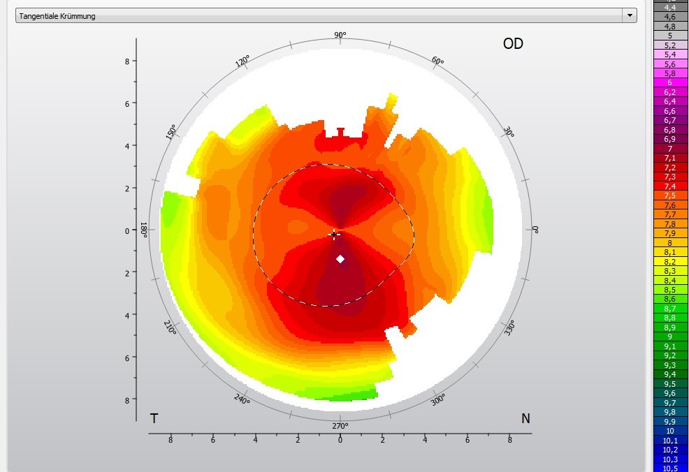 Topo_Asti_vor_Ortho_K